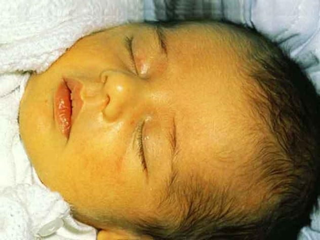 آمبولانس حمل نوزاد | آمبولانس نوزاد