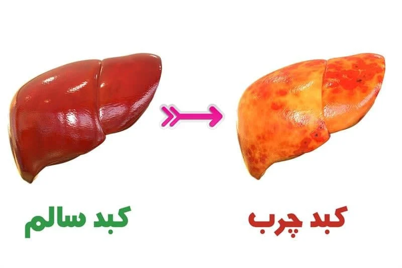 قهوه
