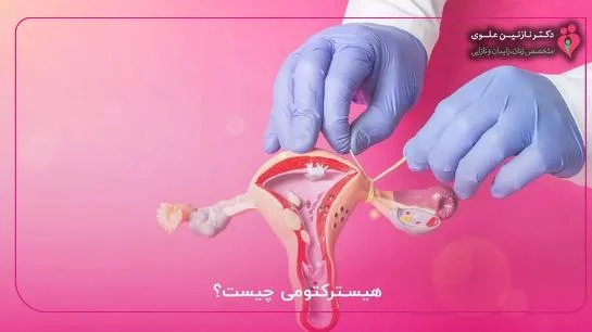 تهران