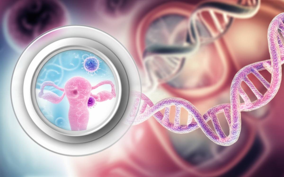 اصفهان | پوست