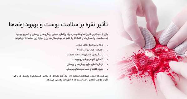 آرامش خواص نقره بر پوست