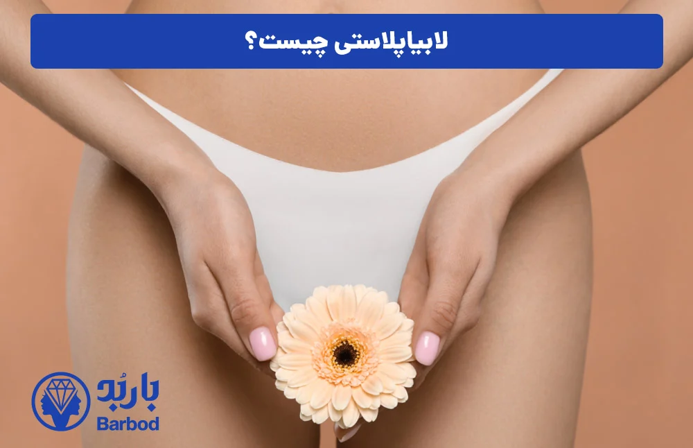 اپل اپل | تهران