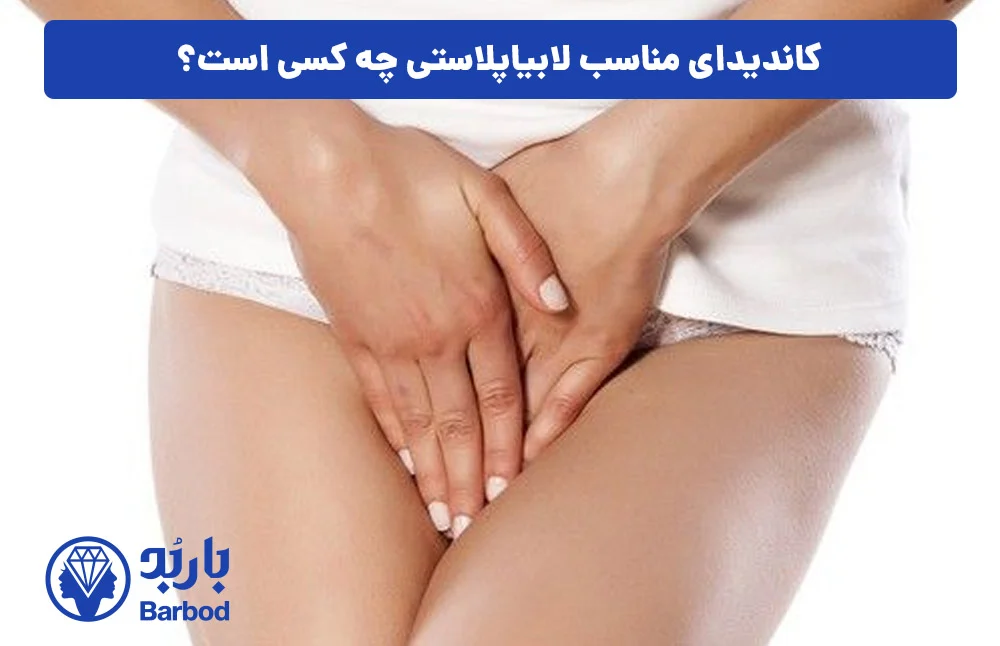 اپل اپل | تهران