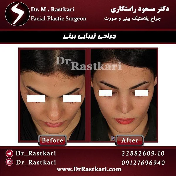 جراحی جراحی | جراحی زیبایی