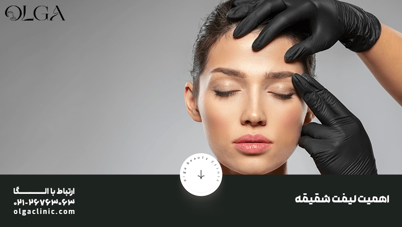 مزایای لیفت شقیقه