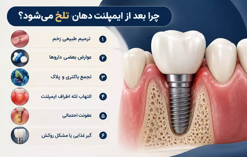 آنتی بیوتیک تلخی دهان بعد از ایمپلنت به خاطر چیست؟