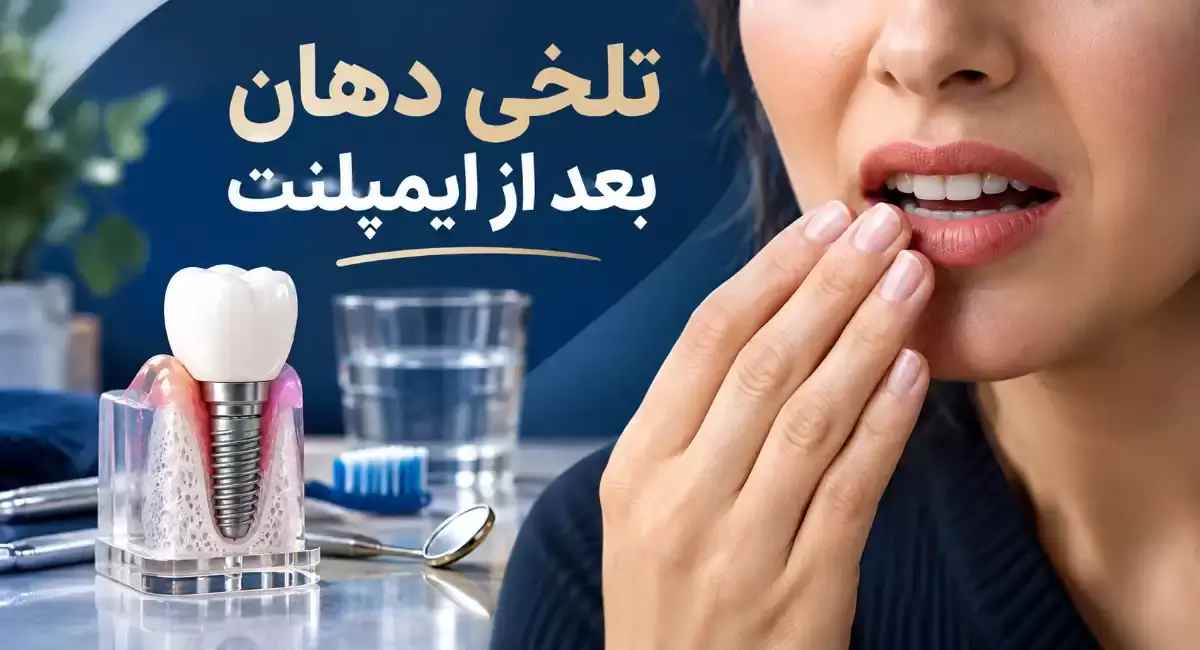 آنتی بیوتیک | ایمپلنت